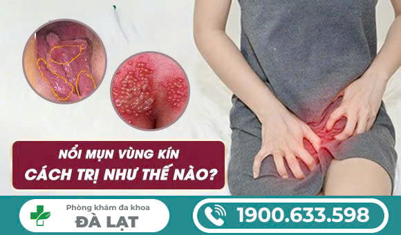 Hình ảnh minh họa